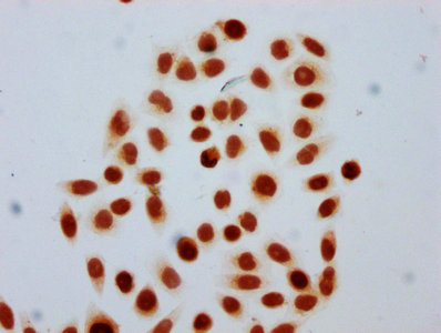HIST1H4I Antibody - Immunocytochemistry analysis diluted at 1:30 and staining in Hela cells(treated with 30mM sodium butyrate for 4h) performed on a Leica BondTM system. The cells were fixed in 4% formaldehyde, permeabilized using 0.2% Triton X-100 and blocked with 10% normal Goat serum 30min at RT. Then primary antibody (1% BSA) was incubated at 4°C overnight. The primary is detected by a biotinylated Secondary antibody and visualized using an HRP conjugated SP system.