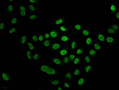 HIST1H4I Antibody - Immunofluorescence staining of Hela cells (treated with 30mM sodium butyrate for 4h) diluted at 1:15, counter-stained with DAPI. The cells were fixed in 4% formaldehyde, permeabilized using 0.2% Triton X-100 and blocked in 10% normal Goat Serum. The cells were then incubated with the antibody overnight at 4°C.The Secondary antibody was Alexa Fluor 488-congugated AffiniPure Goat Anti-Rabbit IgG (H+L) .