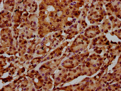 HIST1H4I Antibody - Immunohistochemistry Dilution at 1:100 and staining in paraffin-embedded human pancreatic cancer performed on a Leica BondTM system. After dewaxing and hydration, antigen retrieval was mediated by high pressure in a citrate buffer (pH 6.0). Section was blocked with 10% normal Goat serum 30min at RT. Then primary antibody (1% BSA) was incubated at 4°C overnight. The primary is detected by a biotinylated Secondary antibody and visualized using an HRP conjugated SP system.