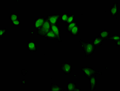 HIST1H4I Antibody - Immunofluorescence staining of Hela cells diluted at 12.5, counter-stained with DAPI. The cells were fixed in 4% formaldehyde, permeabilized using 0.2% Triton X-100 and blocked in 10% normal Goat Serum. The cells were then incubated with the antibody overnight at 4°C.The Secondary antibody was Alexa Fluor 488-congugated AffiniPure Goat Anti-Rabbit IgG (H+L).