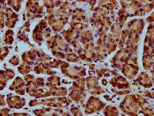 HIST1H4I Antibody - Immunohistochemistry Dilution at 1:25 and staining in paraffin-embedded human pancreatic cancer performed on a Leica BondTM system. After dewaxing and hydration, antigen retrieval was mediated by high pressure in a citrate buffer (pH 6.0). Section was blocked with 10% normal Goat serum 30min at RT. Then primary antibody (1% BSA) was incubated at 4°C overnight. The primary is detected by a biotinylated Secondary antibody and visualized using an HRP conjugated SP system.
