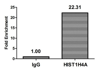 HIST1H4I Antibody - Chromatin Immunoprecipitation Hela (4*10E6) were treated with Micrococcal Nuclease, sonicated, and immunoprecipitated with 5µg anti-HIST1H4A (HIST1H4A (Ab-31) Antibody) or a control normal rabbit IgG. The resulting ChIP DNA was quantified using real-time PCR with primers against the ß-Globin promoter.