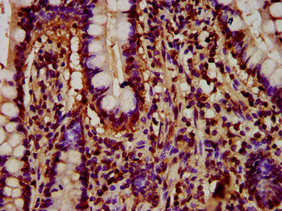 HIST1H4I Antibody - Immunohistochemistry Dilution at 1:5 and staining in paraffin-embedded human small intestine tissue performed on a Leica BondTM system. After dewaxing and hydration, antigen retrieval was mediated by high pressure in a citrate buffer (pH 6.0). Section was blocked with 10% normal Goat serum 30min at RT. Then primary antibody (1% BSA) was incubated at 4°C overnight. The primary is detected by a biotinylated Secondary antibody and visualized using an HRP conjugated SP system.