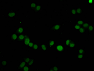 HIST1H4I Antibody - Immunofluorescence staining of Hela cells diluted at 1:15, counter-stained with DAPI. The cells were fixed in 4% formaldehyde, permeabilized using 0.2% Triton X-100 and blocked in 10% normal Goat Serum. The cells were then incubated with the antibody overnight at 4°C.The Secondary antibody was Alexa Fluor 488-congugated AffiniPure Goat Anti-Rabbit IgG (H+L).