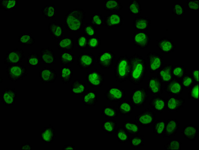 HIST1H4I Antibody - Immunofluorescence staining of Hela cells diluted at 1:10, counter-stained with DAPI. The cells were fixed in 4% formaldehyde, permeabilized using 0.2% Triton X-100 and blocked in 10% normal Goat Serum. The cells were then incubated with the antibody overnight at 4°C.The Secondary antibody was Alexa Fluor 488-congugated AffiniPure Goat Anti-Rabbit IgG (H+L).