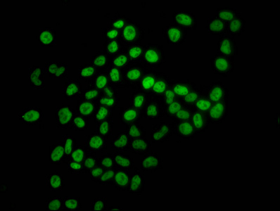 HIST1H4I Antibody - Immunofluorescence staining of Hela cells diluted at 4°C.The Secondary antibody was Alexa Fluor 488-congugated AffiniPure Goat Anti-Rabbit IgG (H+L).