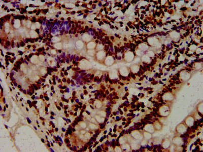 HIST1H4I Antibody - Immunohistochemistry Dilution at 1:10 and staining in paraffin-embedded human small intestine tissue performed on a Leica BondTM system. After dewaxing and hydration, antigen retrieval was mediated by high pressure in a citrate buffer (pH 6.0). Section was blocked with 10% normal Goat serum 30min at RT. Then primary antibody (1% BSA) was incubated at 4°C overnight. The primary is detected by a biotinylated Secondary antibody and visualized using an HRP conjugated SP system.