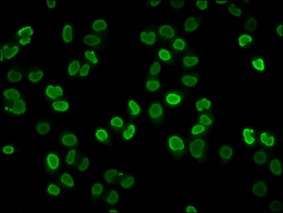 HIST1H4I Antibody - Immunofluorescence staining of Hela cells (treated with 10mM sodium propionate for 4h) diluted at 1:25, counter-stained with DAPI. The cells were fixed in 4% formaldehyde, permeabilized using 0.2% Triton X-100 and blocked in 10% normal Goat Serum. The cells were then incubated with the antibody overnight at 4°C.The Secondary antibody was Alexa Fluor 488-congugated AffiniPure Goat Anti-Rabbit IgG (H+L) .
