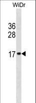 HIST2H2BE Antibody - HIST2H2BE Antibody western blot of WiDr cell line lysates (35 ug/lane). The HIST2H2BE antibody detected the HIST2H2BE protein (arrow).