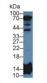 HIST2H2BE Antibody - Western Blot; Sample: Human Liver lysate; Primary Ab: 2µg/mL Rabbit Anti-Human HIST2H2BE Antibody Second Ab: 0.2µg/mL HRP-Linked Caprine Anti-Rabbit IgG Polyclonal Antibody