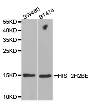 HIST2H2BE Antibody - Western blot analysis of extracts of various cell lines.