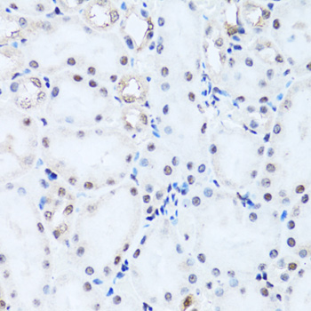 HIST2H2BE Antibody - Immunohistochemistry of paraffin-embedded rat kidney tissue.