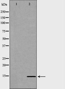 HIST2H2BE Antibody - Western blot analysis of HeLa whole cells lysates using HIST2H2BE antibody. The lane on the left is treated with the antigen-specific peptide.