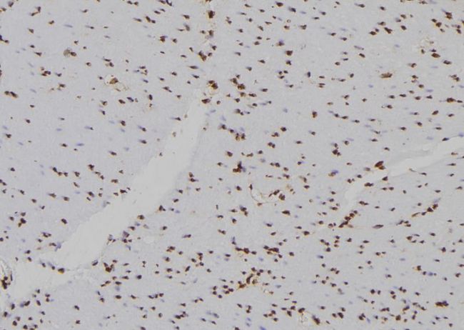 HIST2H2BE Antibody - 1:100 staining human gastric tissue by IHC-P. The sample was formaldehyde fixed and a heat mediated antigen retrieval step in citrate buffer was performed. The sample was then blocked and incubated with the antibody for 1.5 hours at 22°C. An HRP conjugated goat anti-rabbit antibody was used as the secondary.