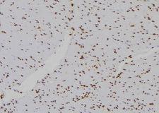 HIST2H2BE Antibody - 1:100 staining human gastric tissue by IHC-P. The sample was formaldehyde fixed and a heat mediated antigen retrieval step in citrate buffer was performed. The sample was then blocked and incubated with the antibody for 1.5 hours at 22°C. An HRP conjugated goat anti-rabbit antibody was used as the secondary.