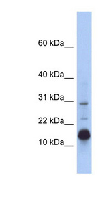 HIST2H2BF Antibody - HIST2H2BF antibody Western blot of Fetal Small Intestine lysate. This image was taken for the unconjugated form of this product. Other forms have not been tested.