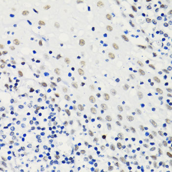 HIST2H4A Antibody - Immunohistochemistry of paraffin-embedded human tonsil using H4K5AC antibody at dilution of 1:100 (40x lens).
