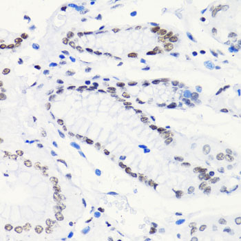HIST2H4A Antibody - Immunohistochemistry of paraffin-embedded human stomach using H4K5AC antibody at dilution of 1:100 (40x lens).