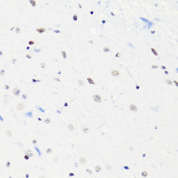 HIST2H4A Antibody - Immunohistochemistry of paraffin-embedded mouse brain using H4K5AC antibody at dilution of 1:100 (40x lens).