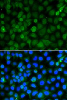 HIST2H4B Antibody - Immunofluorescence analysis of A549 cells.