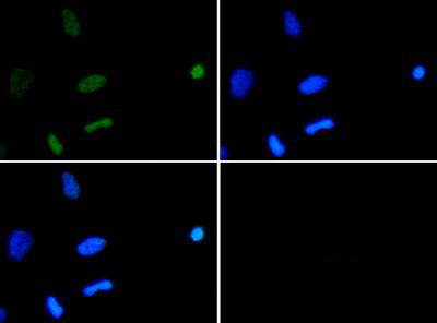 HIST3H3 Antibody - Immunofluorescence of rabbit Anti-Histone H3 [ac Lys18] Antibody. Tissue: HeLa cells. Fixation: 0.5% PFA. Antigen retrieval: Not required. Primary antibody: Histone H3[ac Lys18] antibody at a 1:500 dilution for 1 h at RT. Secondary antibody: Dylight 488 secondary antibody at 1:10,000 for 45 min at RT. Localization: Histone H3 [ac Lys18] is nuclear and chromosomal. Staining: Histone H3 [ac Lys18] is expressed in green, nuclei are counterstained with DAPI (blue).