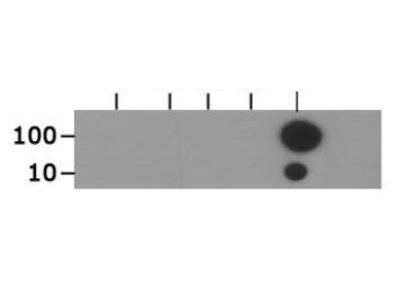 HIST3H3 Antibody - Dot Blot of rabbit Histone H3 [ac Lys18] Antibody. Lane 1: unmodified. Lane 2: Me1. Lane 3: Me2. Lane 4: Me3. Lane 5: Ac. Load: 10 and 100 picomoles of peptide. Primary antibody: Histone H3 [ac Lys18] antibody at 1:1000 for 45 min at 4°C. Secondary antibody: DyLight 488 rabbit secondary antibody at 1:10,000 for 45 min at RT. Block: 5% BLOTTO overnight at 4°C.
