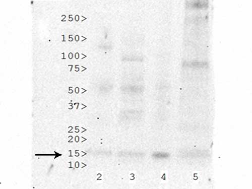 HIST3H3 Antibody - Western Blot of Histone H3 [ac Lys27] (RABBIT) Antibody. Western Blot analysis against untreated cell extracts. Lane 2: HeLa cell lysates. Lane 3: NIH/3T3 cell lysates. Lane 4: Cos 7 cell lysates. Lane 5: C. Elegans lysates. Load: 35 µg per lane. Primary antibody: Histone H3 [ac Lys27] antibody at 1:400 for overnight at 4°C. Secondary antibody: rabbit secondary antibody at 1:10,000 for 45 min at RT. Block: 5% BLOTTO overnight at 4°C. Predicted/Observed size: 15 kDa for Histone H3 [ac Lys27]. Other band(s): non-specific.