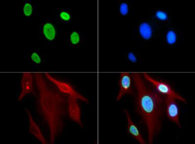 HIST3H3 Antibody - Immunofluorescence of rabbit Anti-Histone H3 [ac Lys9] Antibody. Tissue: HeLa cells. Fixation: 0.5% PFA. Antigen retrieval: Not required. Primary antibody: Histone H3 [ac Lys9] antibody at a 1:100 dilution for 1 h at RT. Secondary antibody: FITC secondary antibody at 1:10,000 for 45 min at RT. Localization: Histone H3 [ac Lys9] is nuclear and chromosomal. Staining: Histone H3 [ac Lys9] is expressed in green.