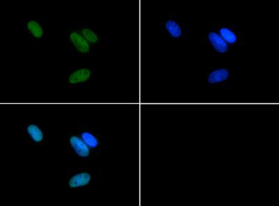 HIST3H3 Antibody - Immunofluorescence of rabbit Anti-Histone H3 [Asym-dimethyl Arg17] Antibody. Tissue: HeLa cells. Fixation: 0.5% PFA. Antigen retrieval: Not required. Primary antibody: Histone H3 [Asym-dimethyl Arg17] antibody at a 1:50 dilution for 1 h at RT. Secondary antibody: FITC secondary antibody at 1:10,000 for 45 min at RT. Localization: Histone H3 [Asym-dimethyl Arg17] is nuclear and chromosomal. Staining: Histone H3 [Asym-dimethyl Arg17] is expressed in green, nuclei are counterstained with Dapi (blue).