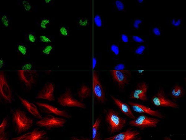 HIST3H3 Antibody - Immunofluorescence of Anti-Histone H3 pT3/R2Me2s: Histone H3 pT3/R2Me2s antibody was tested at 1:50 in HeLa cells with FITC (green). Nuclei were counterstained with DAPI (blue).