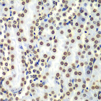 HIST3H3 Antibody - Immunohistochemistry of paraffin-embedded mouse kidney using HIST3H3 antibody at dilution of 1:100 (40x lens).