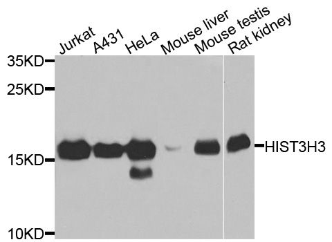 HIST3H3 Antibody - Western blot analysis of extracts of various cell lines, using HIST3H3 antibody at 1:1000 dilution. The secondary antibody used was an HRP Goat Anti-Rabbit IgG (H+L) at 1:10000 dilution. Lysates were loaded 25ug per lane and 3% nonfat dry milk in TBST was used for blocking. An ECL Kit was used for detection and the exposure time was 10s.
