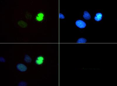 HIST3H3 Antibody - Immunofluorescence of rabbit Anti-Histone H3 [Monomethyl Lys4, p Thr6] Antibody. Tissue: HeLa cells. Fixation: 0.5% PFA. Antigen retrieval: Not required. Primary antibody: Histone H3 [Monomethyl Lys4, p Thr6] antibody at a 1:50 dilution for 1 h at RT. Secondary antibody: FITC secondary antibody at 1:10,000 for 45 min at RT. Localization: Histone H3 [Monomethyl Lys4, p Thr6] is nuclear and chromosomal. Staining: Histone H3 [Monomethyl Lys4, p Thr6] is expressed in green and the nuclei are counterstained with DAPI (blue).