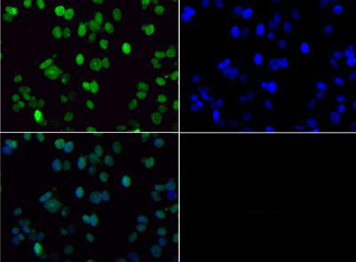 HIST3H3 Antibody - Immunofluorescence of rabbit Anti-Histone H3 [Dimethyl Lys36] Antibody. Tissue: Neuro2a cells. Fixation: 0.5% PFA. Antigen retrieval: Not required. Primary antibody: Histone H3 [Dimethyl Lys36] antibody at a 1:100 dilution for 1 h at RT. Secondary antibody: FITC secondary antibody at 1:10,000 for 45 min at RT. Localization: Histone H3 [Dimethyl Lys36] is nuclear and chromosomal. Staining: Histone H3 [Dimethyl Lys36] is expressed in green, nuclei are counterstained with DAPI (blue).