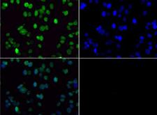 HIST3H3 Antibody - Immunofluorescence of rabbit Anti-Histone H3 [Dimethyl Lys36] Antibody. Tissue: Neuro2a cells. Fixation: 0.5% PFA. Antigen retrieval: Not required. Primary antibody: Histone H3 [Dimethyl Lys36] antibody at a 1:100 dilution for 1 h at RT. Secondary antibody: FITC secondary antibody at 1:10,000 for 45 min at RT. Localization: Histone H3 [Dimethyl Lys36] is nuclear and chromosomal. Staining: Histone H3 [Dimethyl Lys36] is expressed in green, nuclei are counterstained with DAPI (blue).