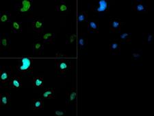 HIST3H3 Antibody - Immunofluorescence of rabbit Anti-Histone H3 [Dimethyl Lys4] Antibody. Tissue: C. elegans embryo lysate. Fixation: 0.5% PFA. Antigen retrieval: Not required. Primary antibody: Histone H3 [Dimethyl Lys4] antibody at a 1:50 dilution for 1 h at RT. Secondary antibody: Dylight 488 secondary antibody at 1:10,000 for 45 min at RT. Localization: Histone H3 [Dimethyl Lys4] is nuclear and chromosomal. Staining: Histone H3 [Dimethyl Lys4] is expressed in green and the nuclei are counterstained blue with DAPI.