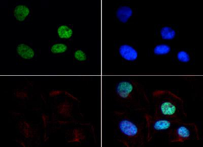HIST3H3 Antibody - Immunofluorescence of rabbit Anti-Histone H3 [Dimethyl Lys9] Antibody. Tissue: HeLa cells. Fixation: 0.5% PFA. Antigen retrieval: Not required. Primary antibody: Histone H3 [Dimethyl Lys9] antibody at a 1:50 dilution for 1 h at RT. Secondary antibody: FITC secondary antibody at 1:10,000 for 45 min at RT. Localization: Histone H3 [Dimethyl Lys9] is nuclear and chromosomal. Staining: Histone H3 [Dimethyl Lys9] is expressed in green and the nuclei are counterstained with DAPI (blue).