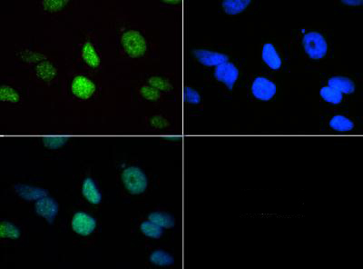 HIST3H3 Antibody - Immunofluorescence of rabbit Anti-Histone H3 [Trimethyl Lys18] Antibody. Tissue: HeLa cells. Fixation: 0.5% PFA. Antigen retrieval: Not required. Primary antibody: Histone H3 [Trimethyl Lys18] antibody at a 1:50 dilution for 1 h at RT. Secondary antibody: FITC secondary antibody at 1:10,000 for 45 min at RT. Localization: Histone H3 [Trimethyl Lys18] is nuclear and chromosomal. Staining: Histone H3 [Trimethyl Lys18] is expressed in green, nuclei are counterstained with DAPI (blue).