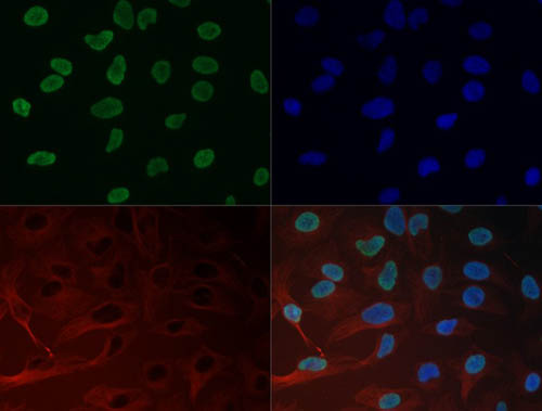 HIST3H3 Antibody - Immunofluorescence of Histone H3 K27me3 Antibody. Tissue: HeLa cells. Fixation: 0.5% PFA. Antigen retrieval: Not required. Primary antibody: Histone H3 K27me3 antibody at a 1:50 dilution for 1 h at RT. Secondary antibody: FITC secondary antibody at 1:10,000 for 45 min at RT. Localization: Histone H3 K27me3 is nuclear and chromosomal. Staining: Histone H3 K27me3 is expressed green and the nuclei are counterstained blue with DAPI.