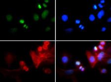 HIST3H3 Antibody - Immunofluorescence of rabbit Anti-Histone H3 [Trimethyl Lys4, p Thr6] Antibody. Tissue: HeLa cells. Fixation: 0.5% PFA. Antigen retrieval: Not required. Primary antibody: Histone H3 [Trimethyl Lys4, p Thr6] antibody at a 1:50 dilution for 1 h at RT. Secondary antibody: FITC secondary antibody at 1:10,000 for 45 min at RT. Localization: Histone H3 [Trimethyl Lys4, p Thr6] is nuclear and chromosomal. Staining: Histone H3 [Trimethyl Lys4, p Thr6] is expressed in green and the nuclei and alpha-tubulin are counterstained with DAPI (blue) and Dylight 594 (red).