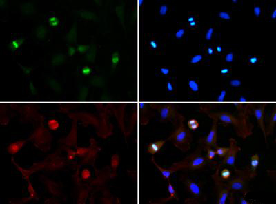 HIST3H3 Antibody - Immunofluorescence of rabbit Anti-Histone H3 [Trimethyl Lys56] Antibody. Tissue: HeLa cells during telophase. Fixation: 0.5% PFA. Antigen retrieval: Not required. Primary antibody: Histone H3 [Trimethyl Lys56] antibody at a 1:100 dilution for 1 h at RT. Secondary antibody: Dylight 488 secondary antibody at 1:10,000 for 45 min at RT. Localization: Histone H3 [Trimethyl Lys56] is nuclear and chromosomal. Staining: Histone H3 [Trimethyl Lys56] is expressed in green, nuclei and alpha-tubulin are counterstained with DAPI (blue) and Dylight 550 (red).