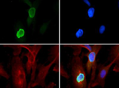 HIST3H3 Antibody - Immunofluorescence of rabbit Anti-Histone H3 [Trimethyl Lys56] Antibody. Tissue: HeLa cells during prophase. Fixation: 0.5% PFA. Antigen retrieval: Not required. Primary antibody: Histone H3 [Trimethyl Lys56] antibody at a 1:100 dilution for 1 h at RT. Secondary antibody: Dylight 488 secondary antibody at 1:10,000 for 45 min at RT. Localization: Histone H3 [Trimethyl Lys56] is nuclear and chromosomal. Staining: Histone H3 [Trimethyl Lys56] is expressed in green, nuclei and alpha-tubulin are counterstained with DAPI (blue) and Dylight 550 (red).