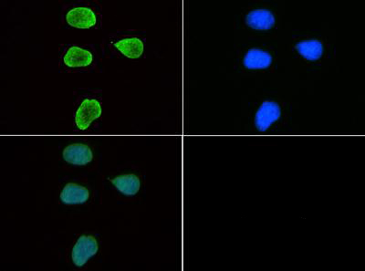 HIST3H3 Antibody - Immunofluorescence of rabbit Anti-Histone H3 [Trimethyl Lys9] Antibody. Tissue: HeLa cells. Fixation: 0.5% PFA. Antigen retrieval: Not required. Primary antibody: Histone H3 [Trimethyl Lys9] antibody at a 1:50 dilution for 1 h at RT. Secondary antibody: FITC secondary antibody at 1:10,000 for 45 min at RT. Localization: Histone H3 [Trimethyl Lys9] is nuclear and chromosomal. Staining: Histone H3 [Trimethyl Lys9] is expressed in green and the nuclei are counterstained with DAPI (blue).