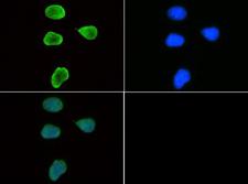 HIST3H3 Antibody - Immunofluorescence of rabbit Anti-Histone H3 [Trimethyl Lys9] Antibody. Tissue: HeLa cells. Fixation: 0.5% PFA. Antigen retrieval: Not required. Primary antibody: Histone H3 [Trimethyl Lys9] antibody at a 1:50 dilution for 1 h at RT. Secondary antibody: FITC secondary antibody at 1:10,000 for 45 min at RT. Localization: Histone H3 [Trimethyl Lys9] is nuclear and chromosomal. Staining: Histone H3 [Trimethyl Lys9] is expressed in green and the nuclei are counterstained with DAPI (blue).