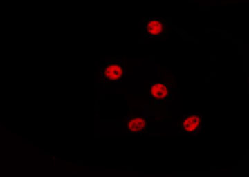 HIST3H3 Antibody - Staining HepG2 cells by IF/ICC. The samples were fixed with PFA and permeabilized in 0.1% Triton X-100, then blocked in 10% serum for 45 min at 25°C. The primary antibody was diluted at 1:200 and incubated with the sample for 1 hour at 37°C. An Alexa Fluor 594 conjugated goat anti-rabbit IgG (H+L) Ab, diluted at 1/600, was used as the secondary antibody.