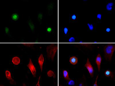 HIST3H3 Antibody - Immunofluorescence Microscopy of rabbit Anti-Histone H3 [ac Lys4, p Thr3] Antibody. Tissue: HeLa cells. Fixation: 0.5% PFA. Antigen retrieval: Not required. Primary antibody: Histone H3 [ac Lys4, p Thr3] antibody at a 1:100 dilution for 1 h at RT. Secondary antibody: Dylight 488 secondary antibody at 1:10,000 for 45 min at RT. Localization: Histone H3 [ac Lys4, p Thr3] is nuclear and chromosomal. Staining: Histone H3 [ac Lys4, p Thr3] is expressed in green while the nuclei and aplpha-tubulin were coexpressed with DAPI (blue) and Dylight 550 (red).