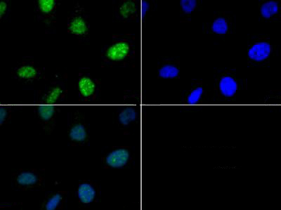 HIST3H3 Antibody - Immunofluorescence of rabbit Anti-Histone H3 [p Thr6] Antibody. Tissue: HeLa cells. Fixation: 0.5% PFA. Antigen retrieval: Not required. Primary antibody: Histone H3 [p Thr6] antibody at a 1:50 dilution for 1 h at RT. Secondary antibody: FITC secondary antibody at 1:10,000 for 45 min at RT. Localization: Histone H3 [p Thr6] is nuclear and chromosomal. Staining: Histone H3 [p Thr6] is expressed in green and the nuclei are counterstained with DAPI (blue).