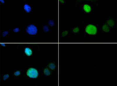 HIST3H3 Antibody - Immunofluorescence of rabbit Anti-Histone H3 [p Thr6, Monomethyl Lys9] Antibody. Tissue: HeLa cells. Fixation: 0.5% PFA. Antigen retrieval: Not required. Primary antibody: Histone H3 [p Thr6, Monomethyl Lys9] antibody at a 1:50 dilution for 1 h at RT. Secondary antibody: FITC secondary antibody at 1:10,000 for 45 min at RT. Localization: Histone H3 [p Thr6, Monomethyl Lys9] is nuclear and chromosomal. Staining: Histone H3 [p Thr6, Monomethyl Lys9] is expressed in green and the nuclei are counterstained with DAPI (blue).