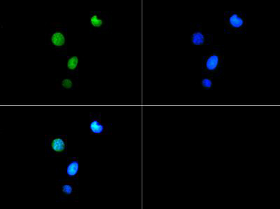 HIST3H3 Antibody - Immunofluorescence of rabbit Anti-Histone H3 [Trimethyl Lys9, p Thr6] Antibody. Tissue: HeLa cells. Fixation: 0.5% PFA. Antigen retrieval: Not required. Primary antibody: Histone H3 [Trimethyl Lys9, p Thr6] antibody at a 1:50 dilution for 1 h at RT. Secondary antibody: FITC secondary antibody at 1:10,000 for 45 min at RT. Localization: Histone H3 [Trimethyl Lys9, p Thr6] is nuclear and chromosomal. Staining: Histone H3 [Trimethyl Lys9, p Thr6] is expressed in green and the nuclei are counterstained with DAPI (blue).