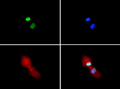 HIST3H3 Antibody - Immunofluorescence of rabbit Anti-Histone H3 [Sym-dimethyl Arg2, Dimethyl Lys4] Antibody. Tissue: HeLa cells. Fixation: 0.5% PFA. Antigen retrieval: Not required. Primary antibody: Histone H3 [Sym-dimethyl Arg2, Dimethyl Lys4] antibody at a 1:100 dilution for 1 h at RT. Secondary antibody: Dylight 488 secondary antibody at 1:10,000 for 45 min at RT. Localization: Histone H3 [Sym-dimethyl Arg2, Dimethyl Lys4] is nuclear and chromosomal. Staining: Histone H3 [Sym-dimethyl Arg2, Dimethyl Lys4] is expressed in green, nuclei and alpha-tubulin are counterstained with DAPI (blue) and Dylight 594 (red).